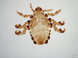 anoplura, anopluros